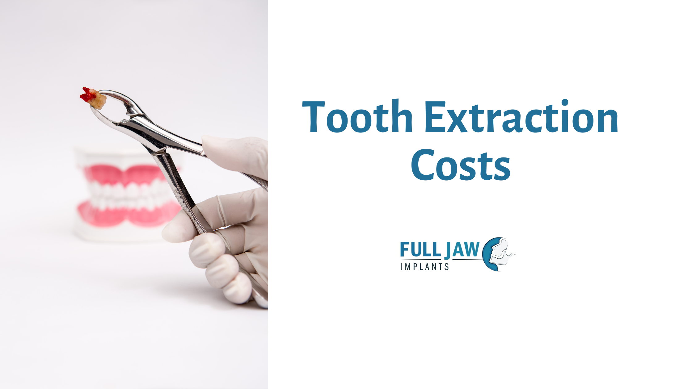 Tooth extraction costs