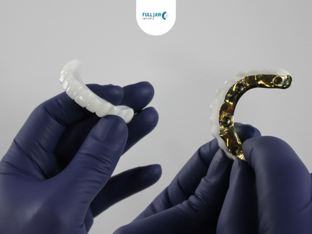 all-on-4 dental implants