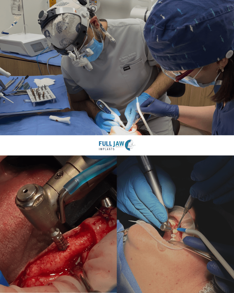 The Ultimate Guide to Dental Implants 