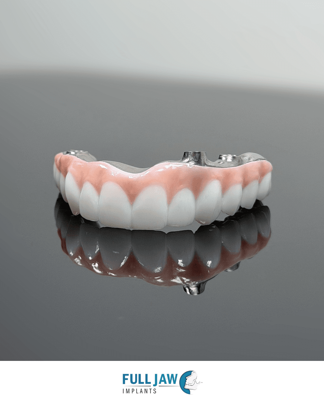 Dental Implants Adelaide
