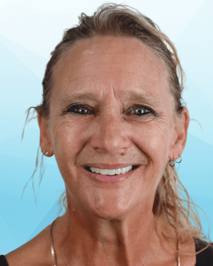 Dental Implants After