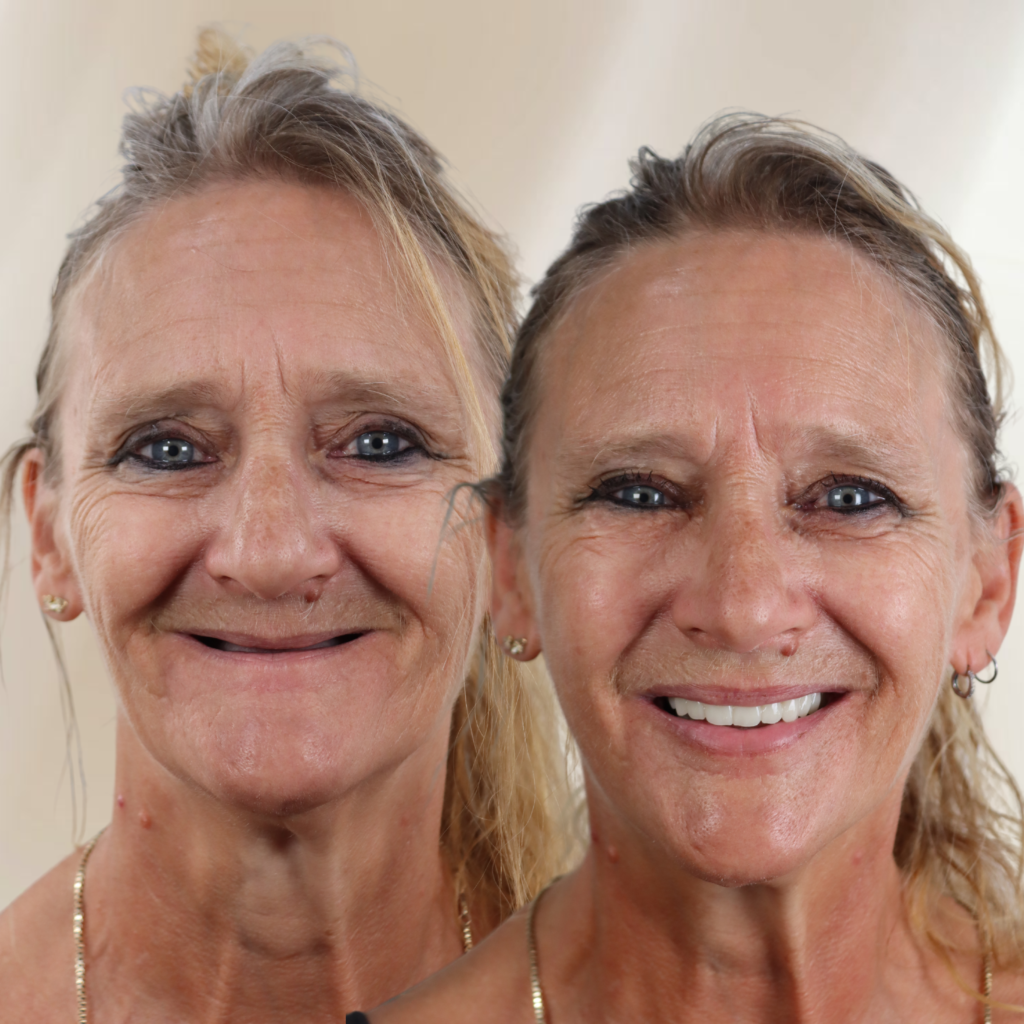 before and after